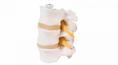 3 Lumbar Vertebrae