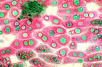 Prepared Microscope Slide. Fat