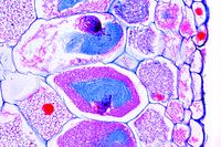 Prepared Microscope Slide. Neottia nidus avis