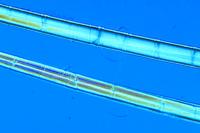 Prepared Microscope Slide. Sclerenchyma fibres of phloem