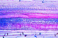 Prepared Microscope Slide. Monocot and dicot stems