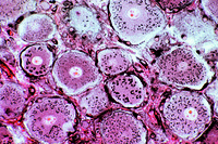 Prepared Microscope Slide. Golgi apparatus in sec. of spinal ganglion or other organ *