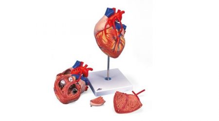 Heart with Bypass, 2 times life size, 4 part